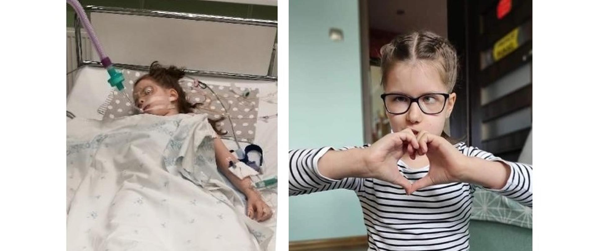 Zdjęcie przedstawia dwa ujęcia dziewczynki- Amelki Bartoszak. Z lewej strony dziewczynka leży na łóżku szpitalnym, podłączona do aparatury. Z prawej strony Amelka w okularach z dłońmi złożonymi w kształt serca.