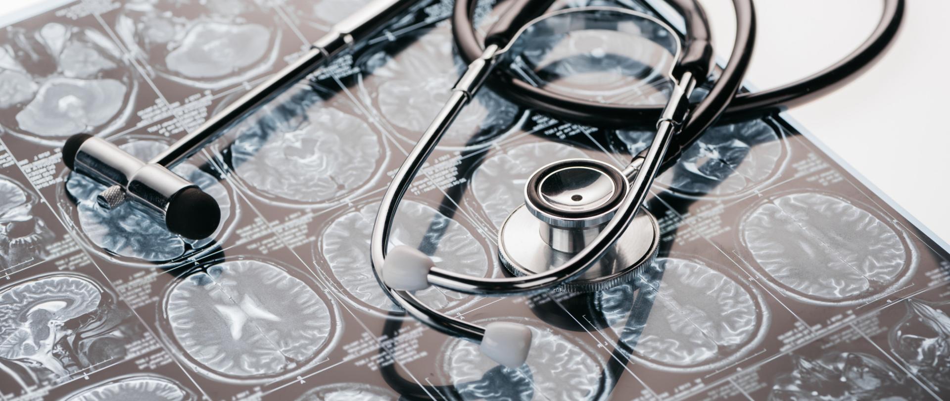 Na zdjęciu jest rezonans mózgu, na którym leży stetoskop.