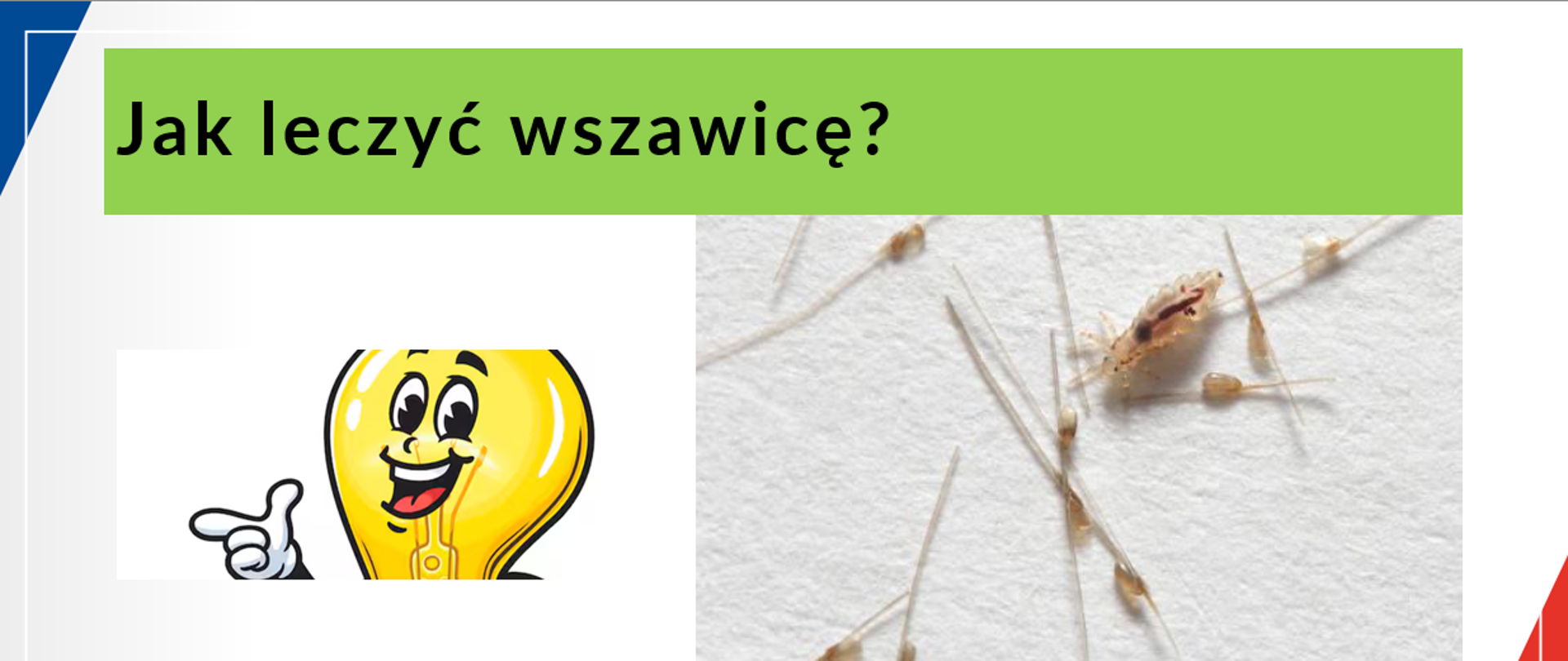 Jak leczyć wszawicę?
