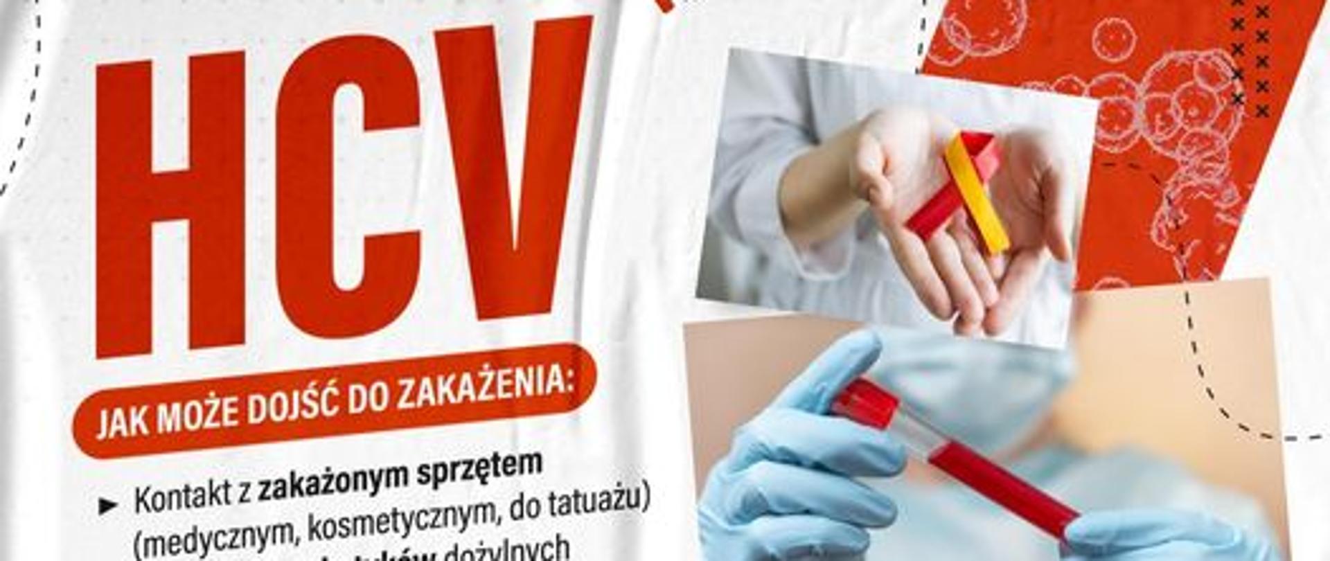 Międzynarodowy Dzień Walki z Wirusowym Zapaleniem Wątroby Typu C. Wirus powodujący tę chorobę nazywany jest również HCV