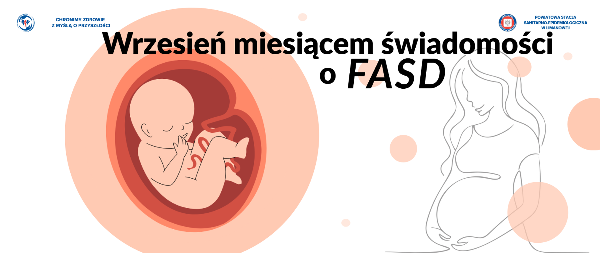 FASD