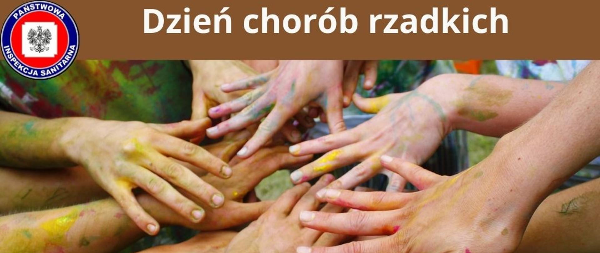 29 lutego – Światowy Dzień Chorób Rzadkich