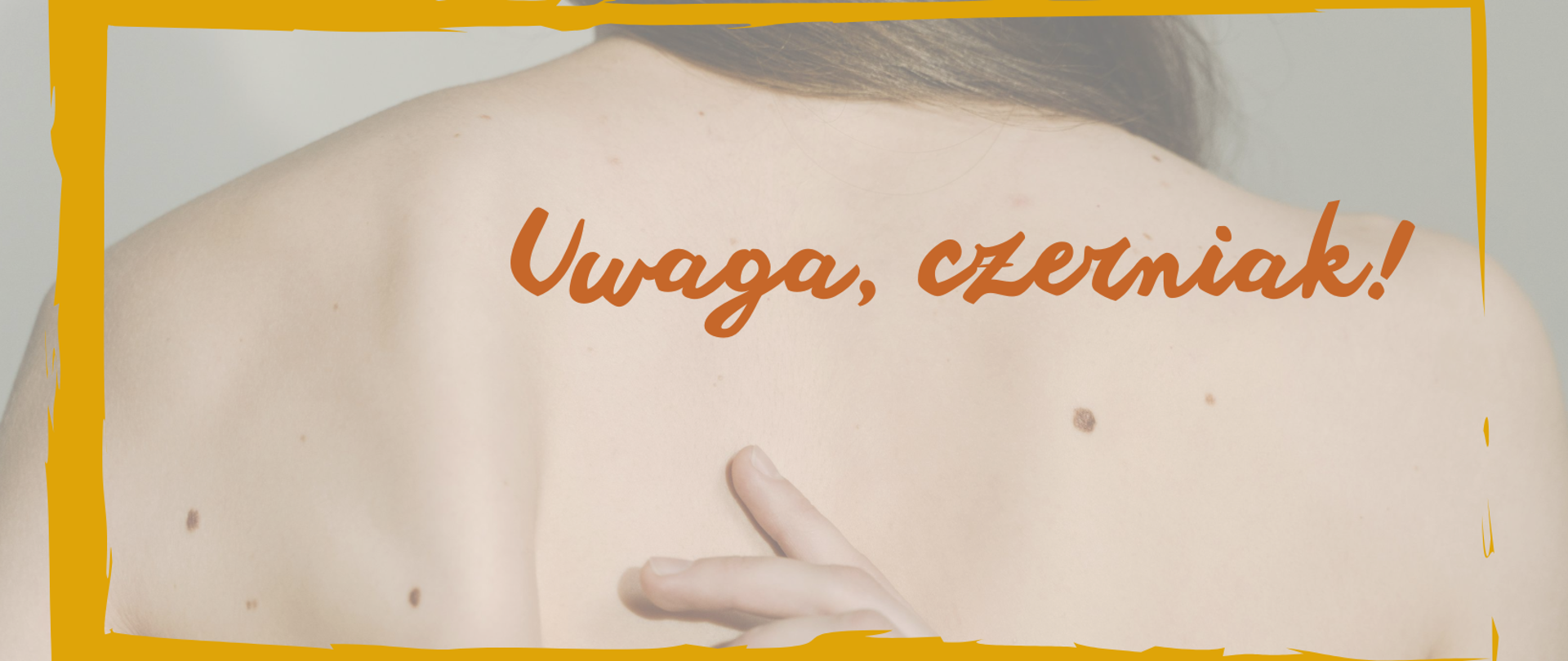 Uwaga_czerniak_26