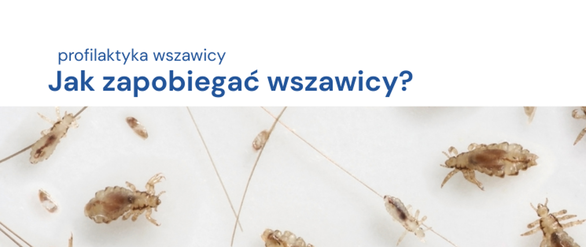 Jak zapobiegać wszawicy 