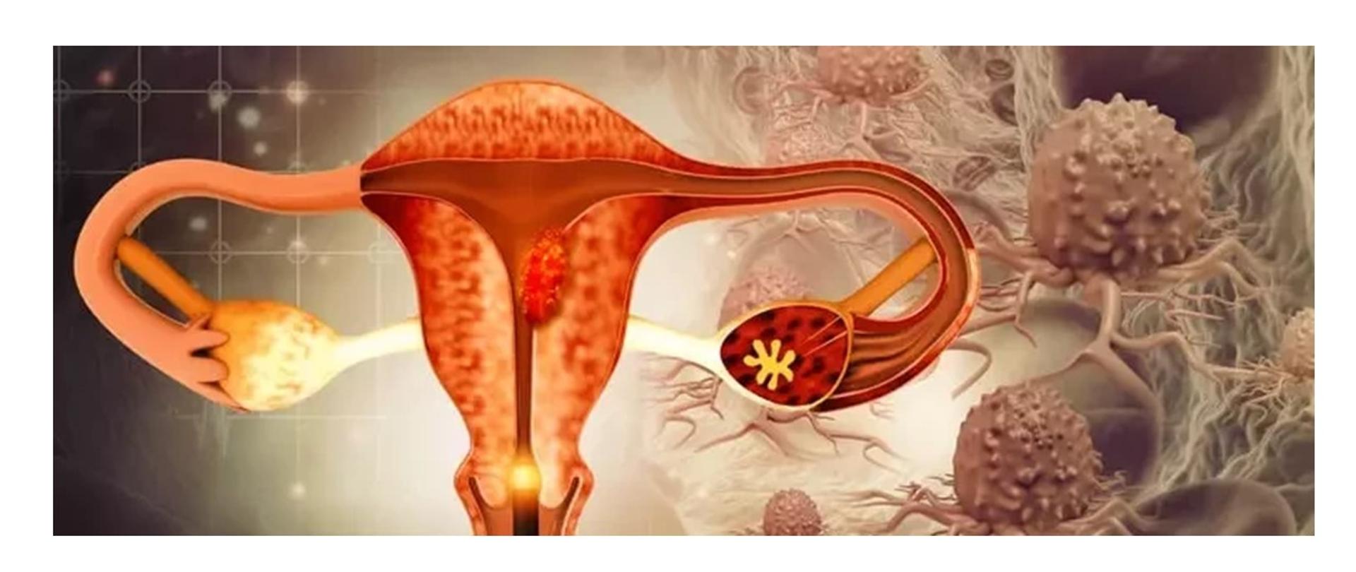 RAK_SZYJKI_MACICY_STYCZEŃ_2024