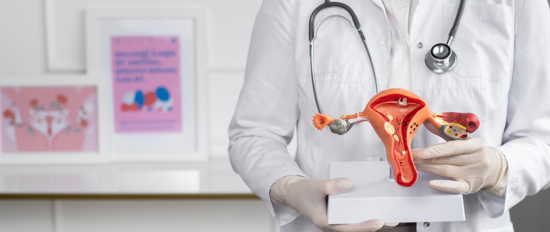 Zdjęcie przedstawia postać lekarza trzymająca w dłoniach model damskich narządów rozrodczych