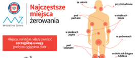 Miejsca żerowania TT