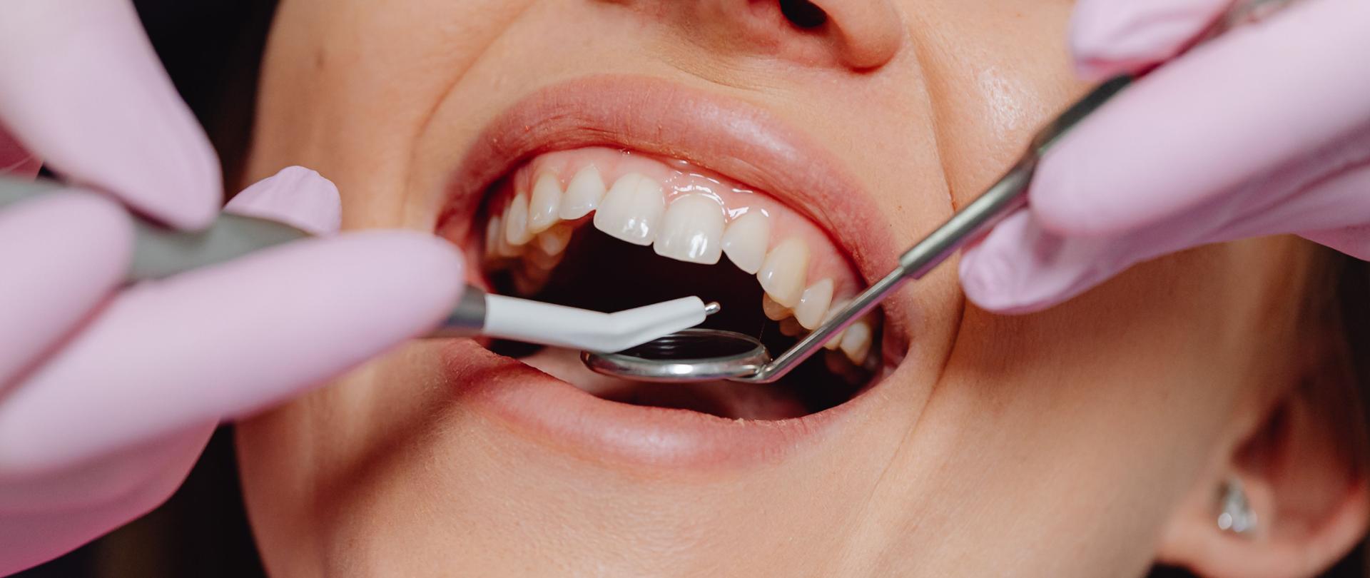 Światowy Dzień Zdrowia Jamy Ustnej