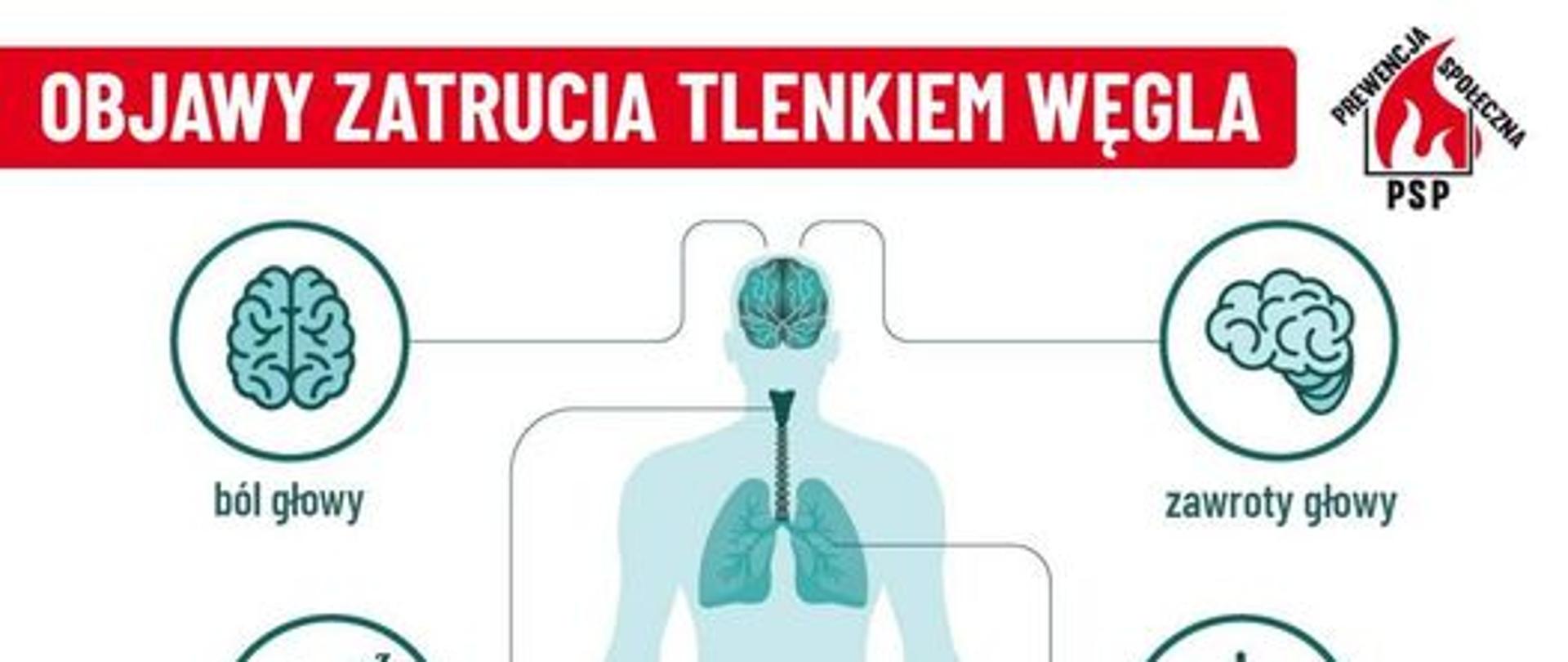 objawy zatrucia tlenkiem węgla