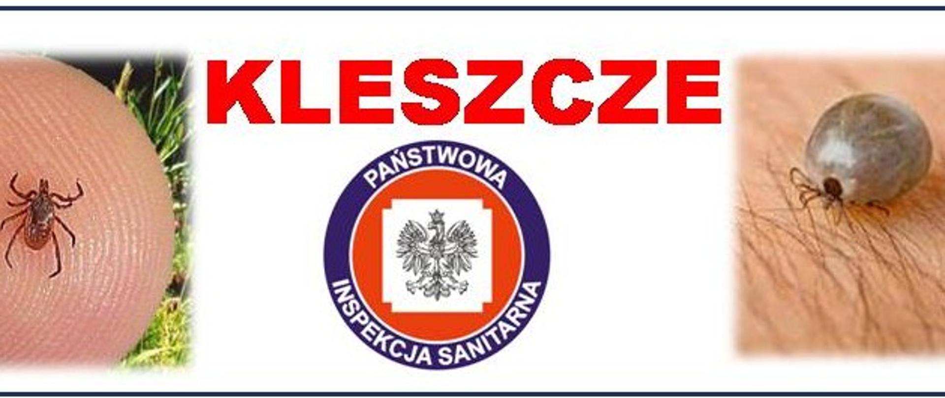 kleszcze