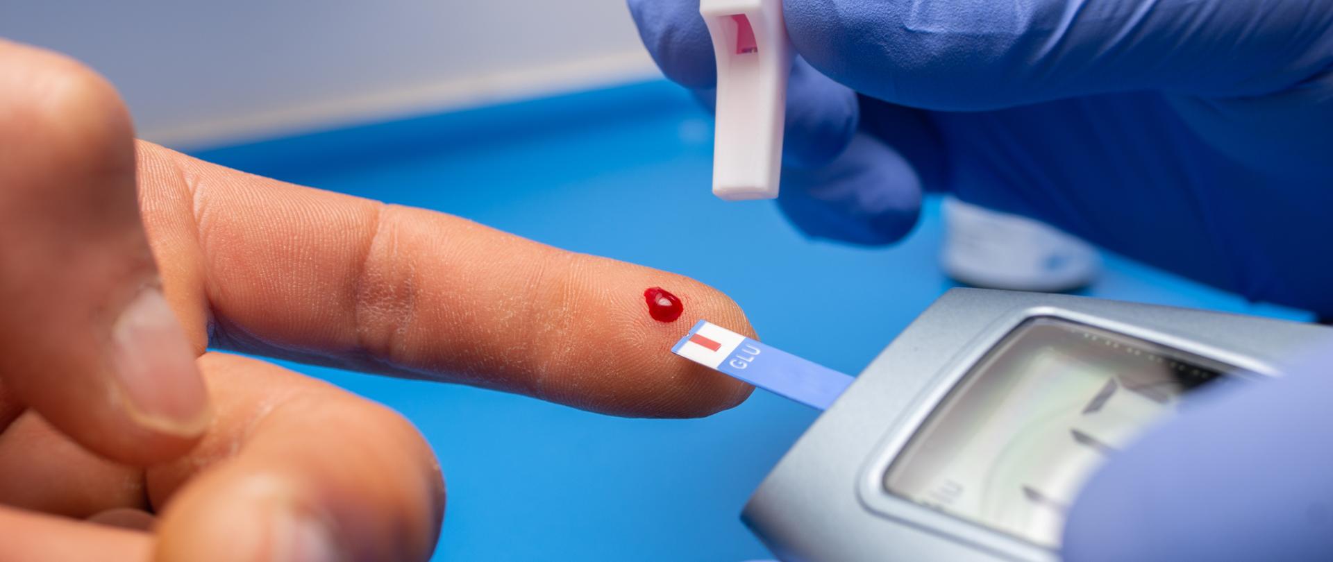 Zdjęcie przedstawia w jaki sposób wykonuje się pomiar poziomu glukozy we krwi. W rękawiczkach oraz za pomocą glukometru pielęgniarka wykonuje badanie umieszczając kroplę świeżej krwi na pasku testowym do glukometru.