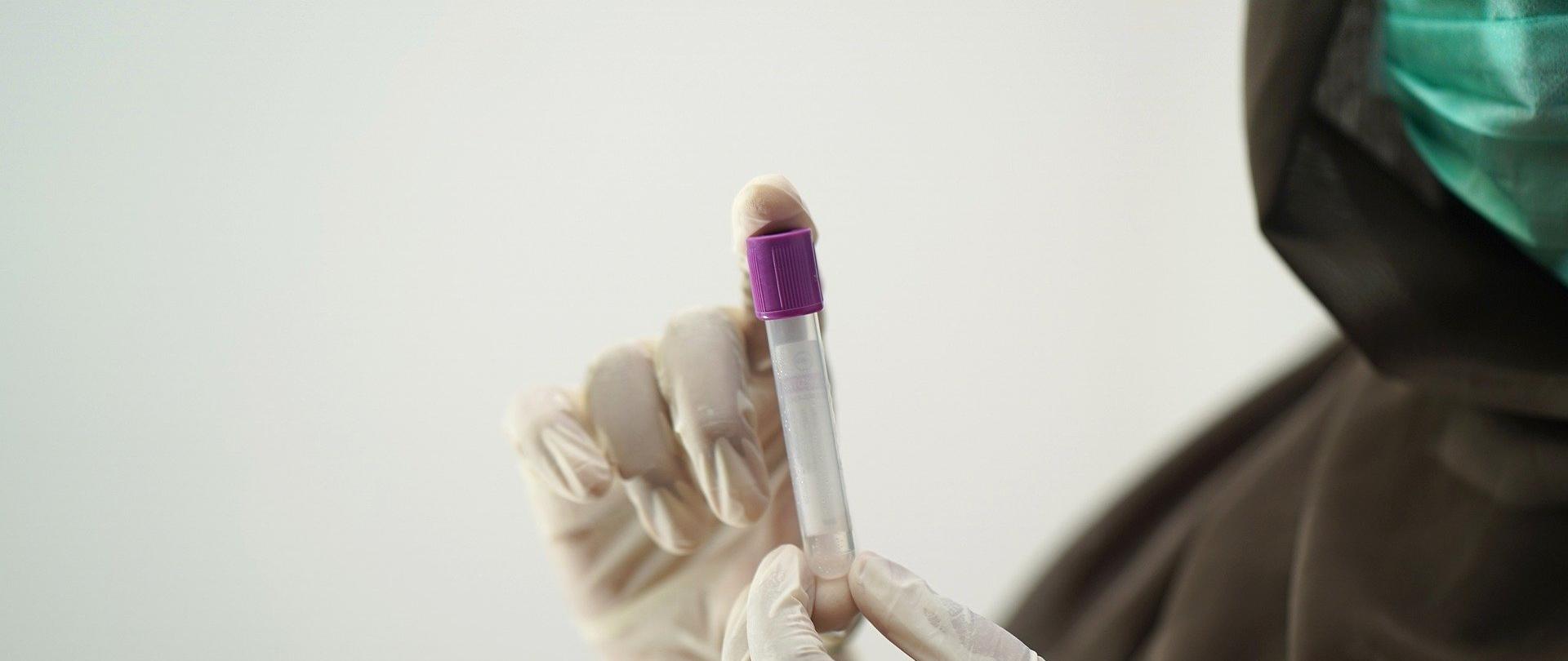 Ręcę w rękawiczkach jednorazowych trzymające próbkę do pobrania badań laboratoryjnych 