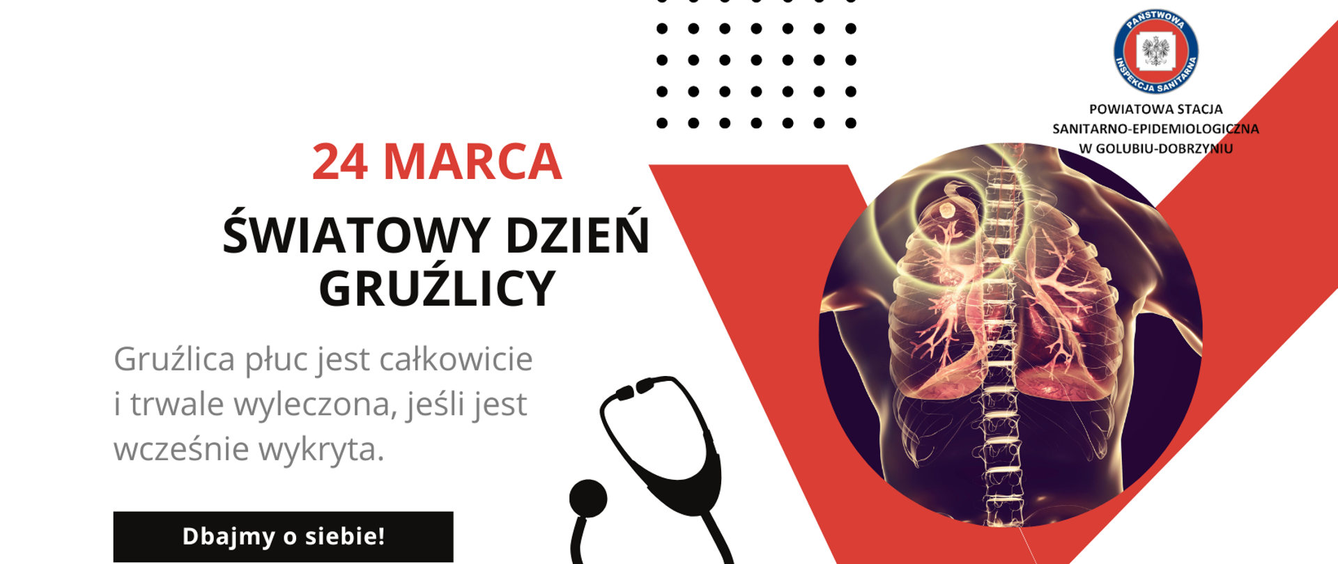 Światowy Dzień Gruźlicy
