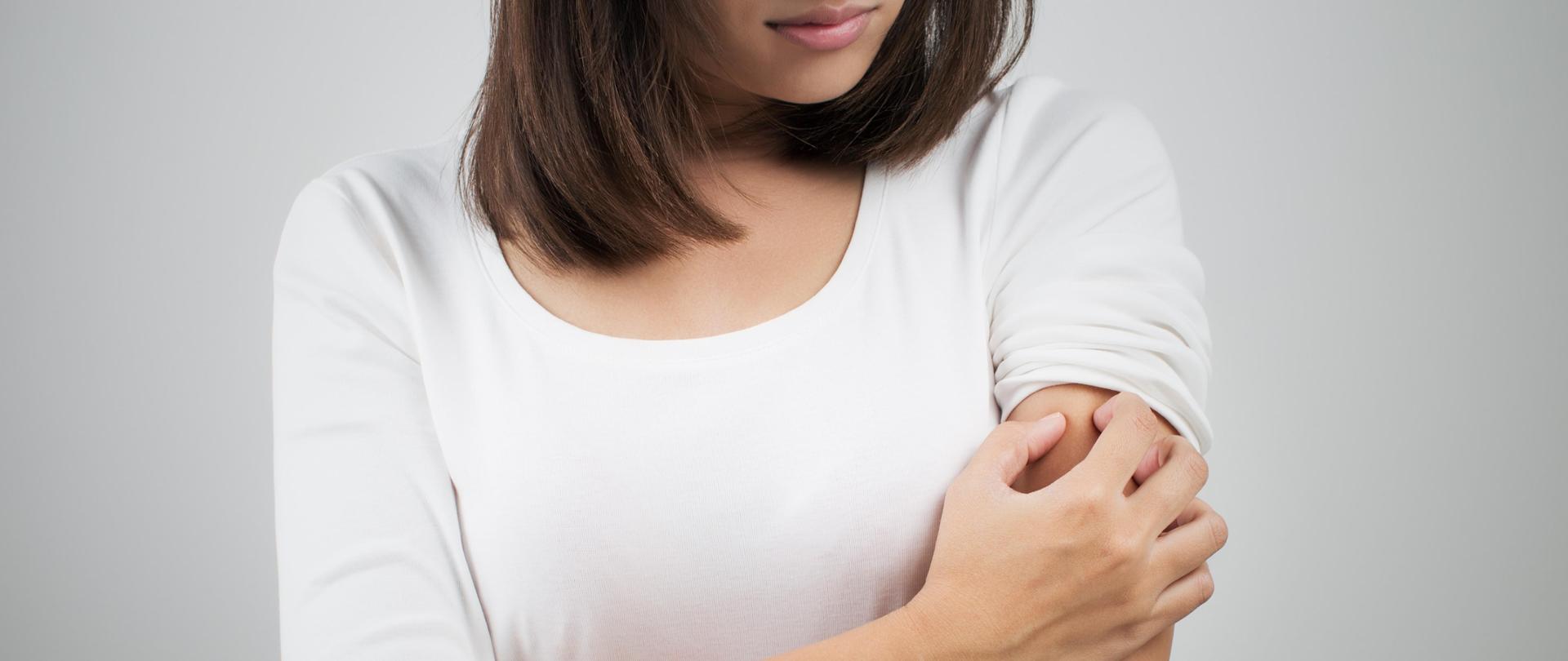 Kobieta w białej bluzce drapiąca się po ramieniu.
