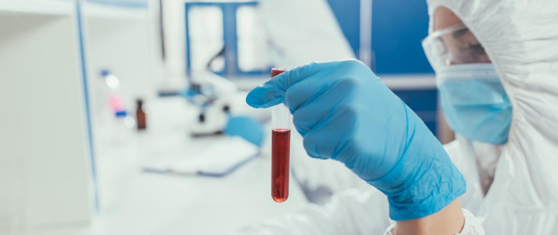 Na zdjęcia jest diagnosta laboratoryjny z próbką krwi w ręku. W tle widać laboratorium.