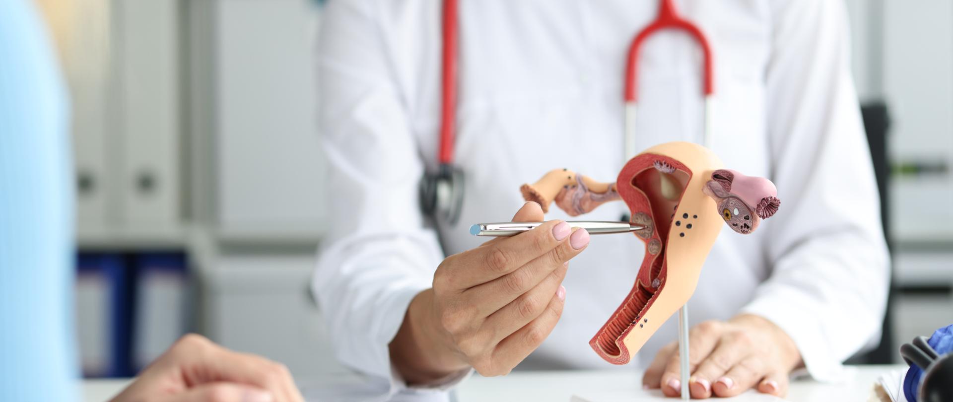 lekarka tłumacząca pacjentce chorobę na modelu anatomicznym macicy