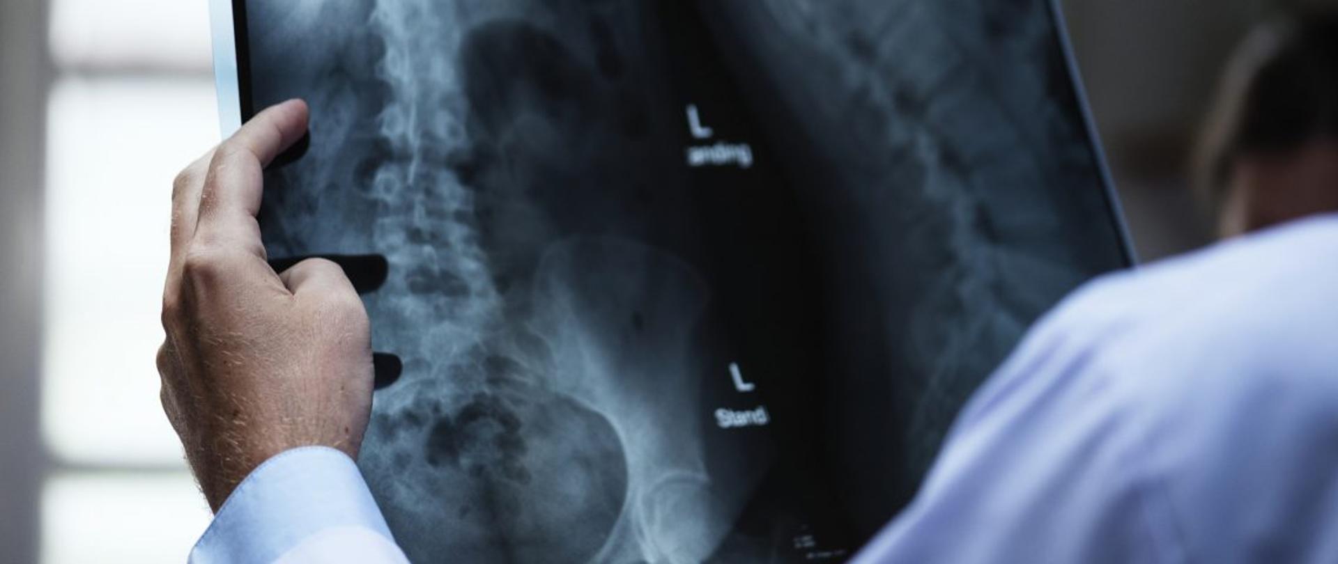 Ochrona-Radiologiczna-Pacjenta-1140x520