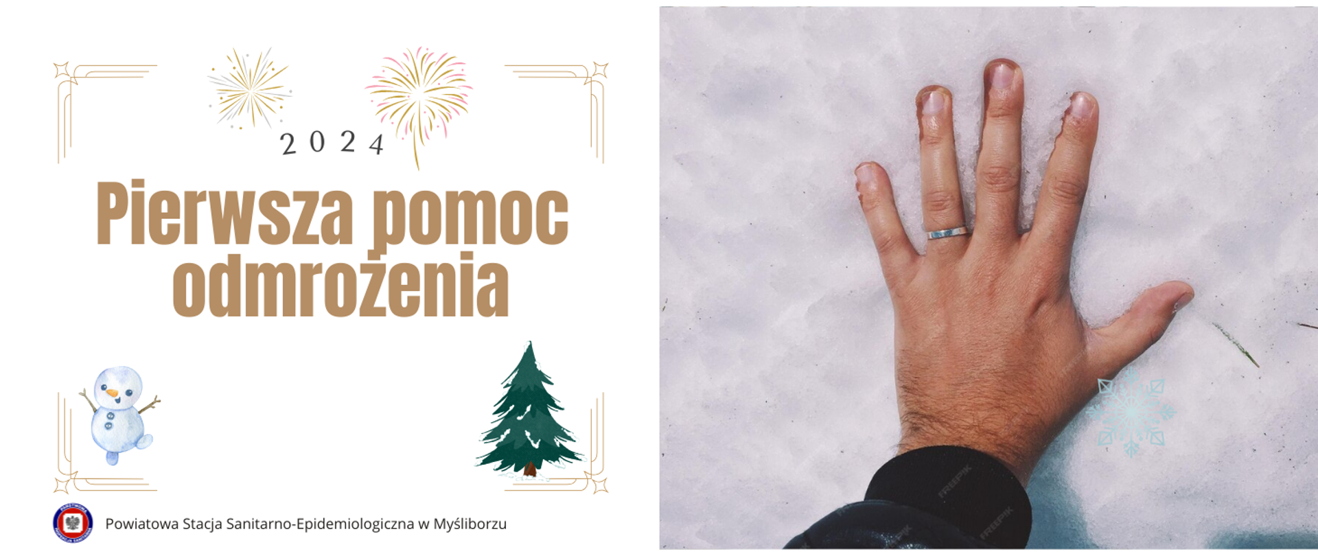 Baner - Pierwsza pomoc - odmrożenia