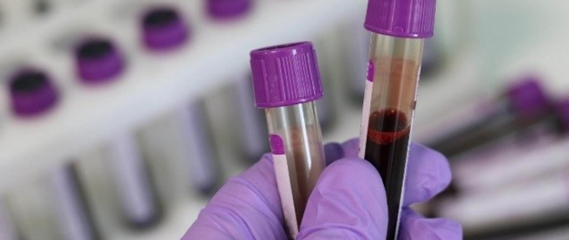 Światowy Dzień Walki z Nowotworami Krwi