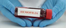 Hemofilia