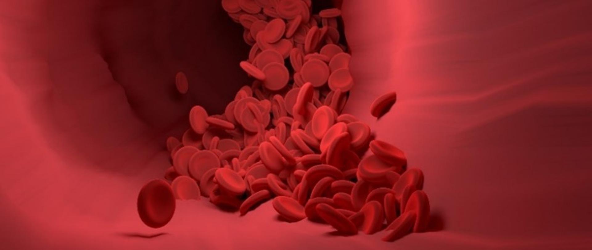 Światowy Dzień Anemii Sierpowatej