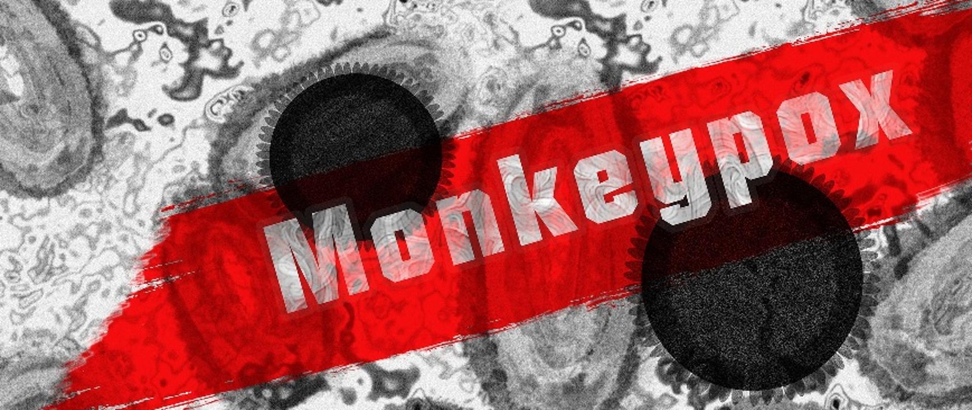 Na biało-czarnym tle wizerunku wirusa spod mikroskopu umieszczony jest na czerwonym tle biały napis Monkeypox (Małpia ospa)