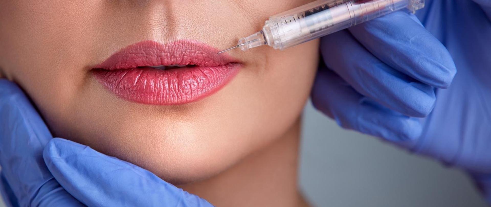 
Botoks - zbliżenie na usta ze strzykawką