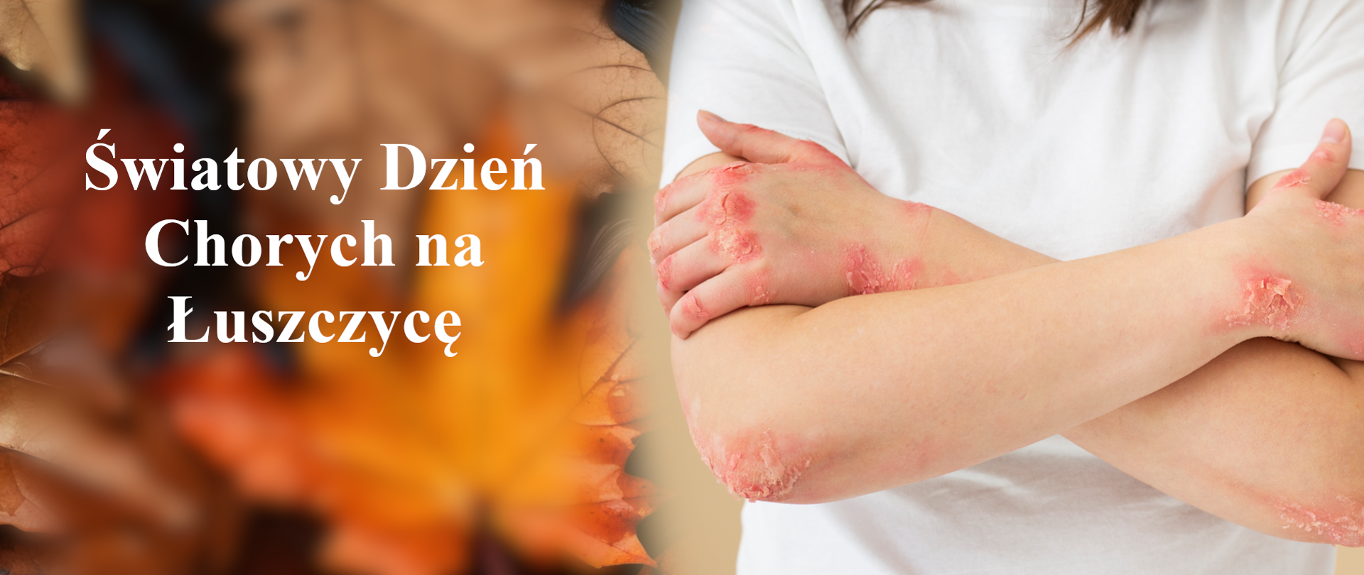 baner - Światowy Dzień Chorych na Łuszczycę