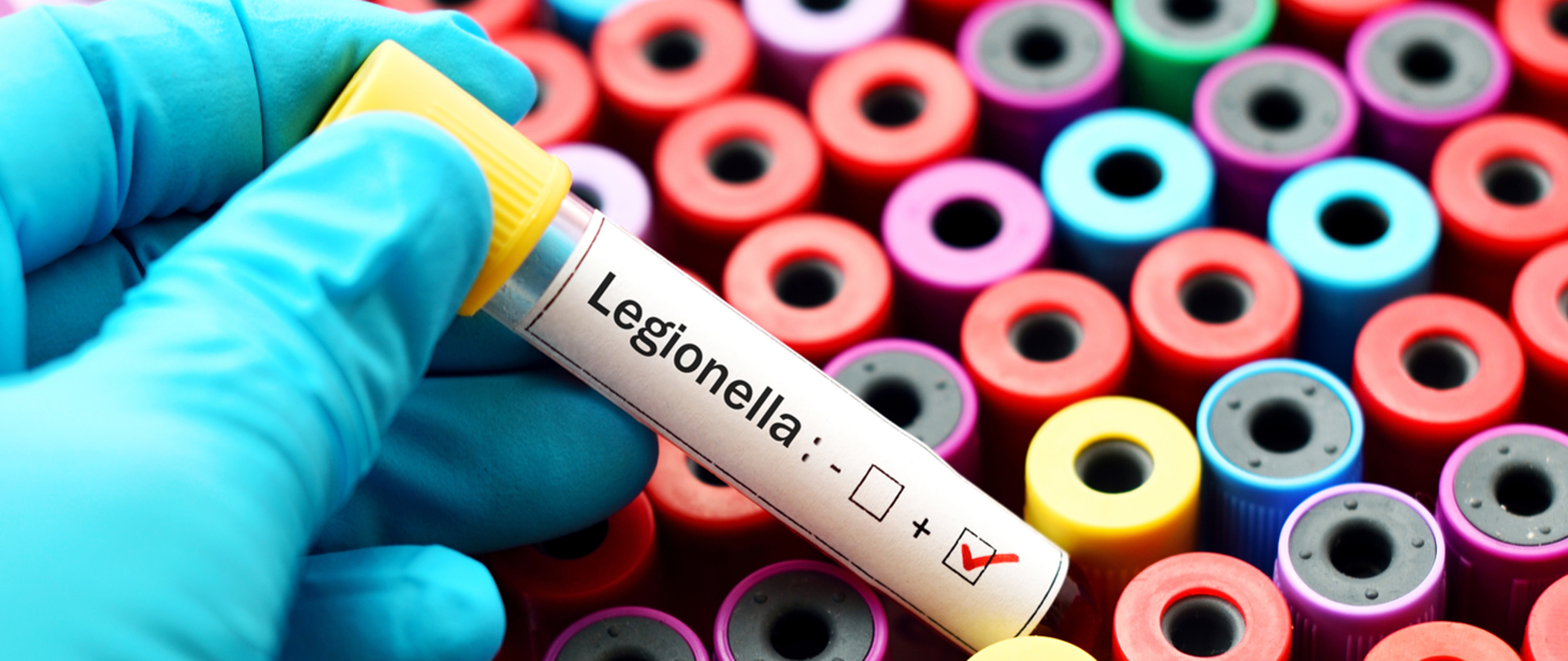Fiolka z etykietą - Legionella: +. W tle kilkadziesiąt podobnych.