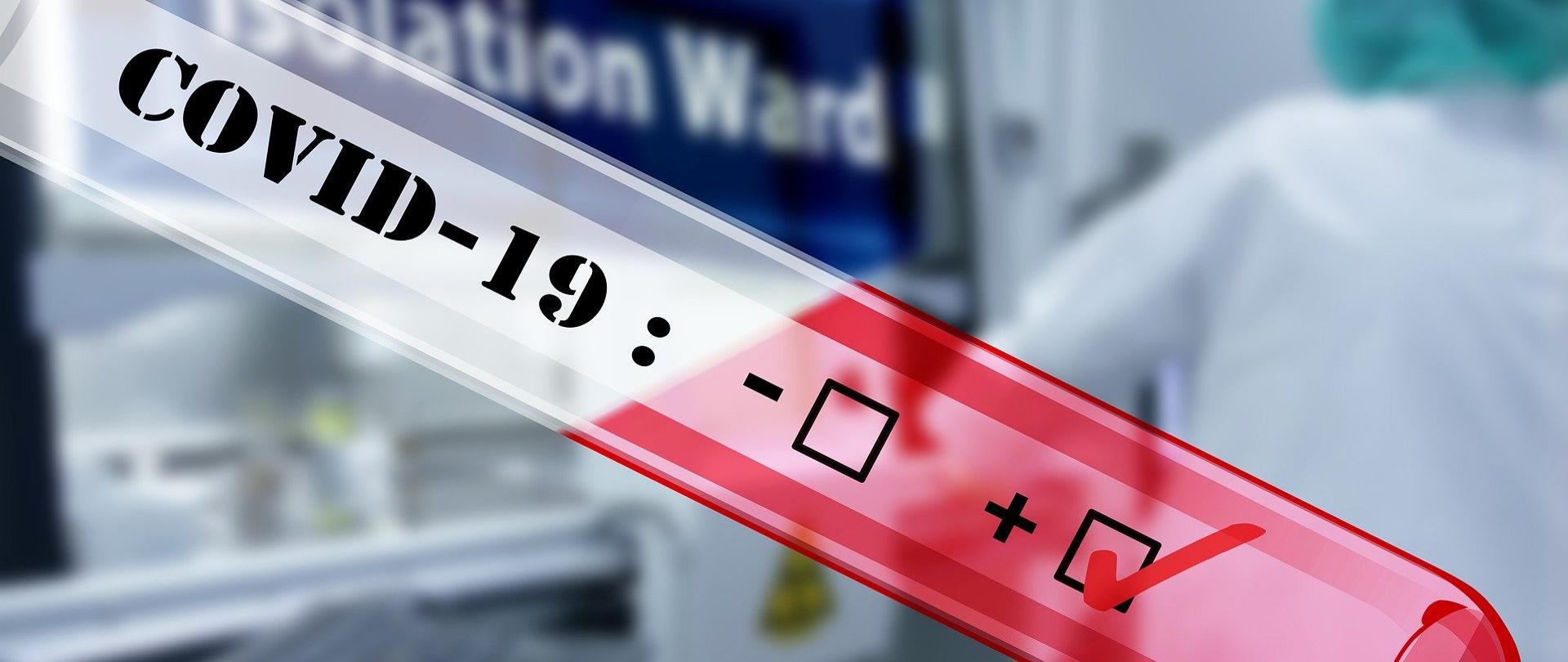 Dodatni wynik testu na Covid-19